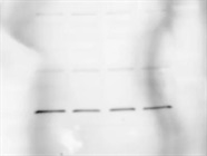 Best FPN Antibody Out There