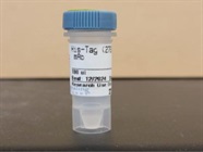 Good Antibody to Detect His-Tagged Proteins
