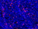 Great Anti-CD3 Antibody for Immunofluorescent Staining for Paraffin Tissue