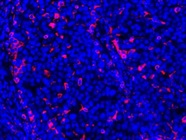 Great Anti-CD3 Antibody for Immunofluorescent Staining for Paraffin Tissue
