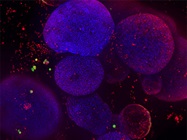 Dynamic Quantification of Cancer Cell Metabolism Using Live-Cell Analysis