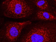 Good Antibody for Cathepsin B