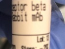 Great PDGF Used for Western Blot Detection