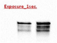Great NCAM-1 for Western Blot