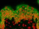Bright CB2 Immunostaining