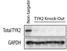 Good Western Blot Antibody for TYK2 Protein