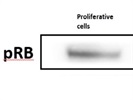 Phospho-Rb (Ser807/811) Antibody for Western Blot