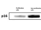 Sensitive P16 INK4A Rabbit mAb for Western Blot