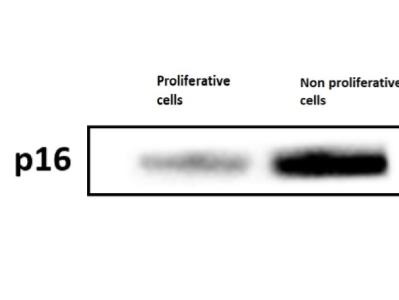Sensitive P16 INK4A Rabbit mAb for Western Blot | Biocompare Antibody ...