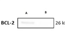 Bcl-2 (124) Mouse mAb for Western Blot