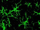 Staining for Microglia in Mouse Brain Sections