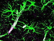 A Guide to Astrocyte Markers