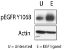 Good Western Blot Antibody to Measure EGFR Phosphorylation Levels