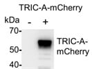 Fast and Efficient Trans-Blot Turbo™ Transfer System