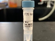 Time Course Effect of Chemoattractant on STIM2 Expression