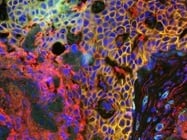 Multiplex imaging addressing spatial biology