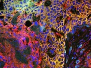 Multiplex imaging addressing spatial biology