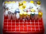 Infographic: Tips and Tricks for Freezing and Thawing Cells