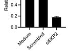 SKP2 siRNA Knocking Down SKP2 in Keratinocytes