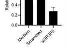 SRp40/SRSF5 siRNA Transfection