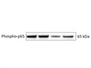 Phospho-NF-KB p65 (Ser536) (93H1) mAb for Western Blot
