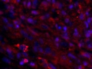 Quality Product for a Difficult Receptor