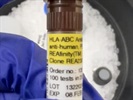Effectively Tags Non-Trophoblast Populations