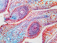Infographic: Tips for Preparing Single-Cell Suspensions from Solid Tissues