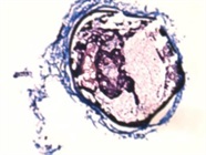 Good Kit to Visualize Platelets and Fibrin