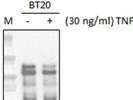 Anti-E-Cadherin Antibody