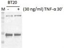 Good Anti-NFkB p65 Antibody