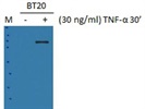 Excellent Anti-p-S176S180-IKKaIKKß Antibody
