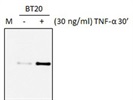 Anti-p-S465S467-Smad2 Antibody Works Well