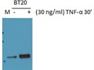 Anti-p-S536-NFkB p65 Antibody Works Very Well