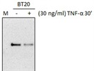 Really Great Anti-SMAD2 Antibody