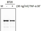 Anti-Stat3 Antibody Works Well