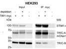 TMEM38B Antibody Detects Endogenous TMEM38B Protein in HEK293 Cells