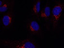 Good RAB6A Antibody for IF
