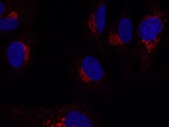 Good RAB6A Antibody for IF