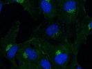 Good BICD2 Antibody for IF