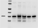 VDAC1 Antibody Works Well