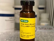 Reliable Secondary Antibody with Clear Detection