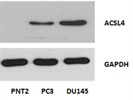 ACSL4 for Western Blot