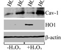 Anti-HO1 Antibody Works Well