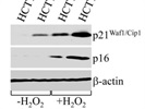 Anti-p21 Antibody Works Well