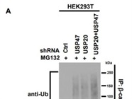 Anti-USP47 Antibody Works Well