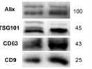 Anti-TSG101 Antibody Works Well