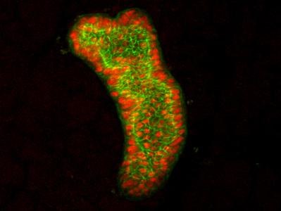 Good GATA3 Antibody for IF | Biocompare Antibody Review