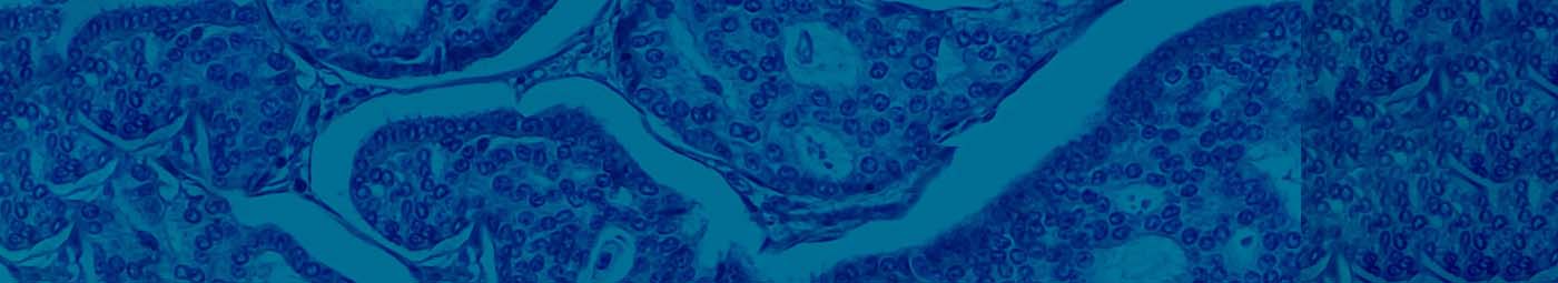  Whole Exome Sequencing