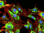 High-Content Screening, Imaging, and Analysis